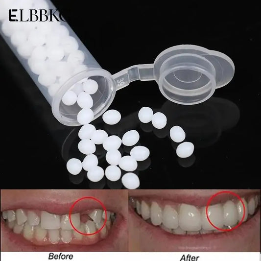 Teeth Repair Glue – Dental Fix Solution