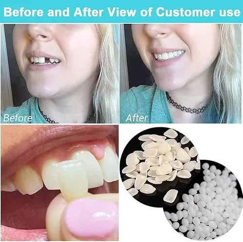 Teeth Repair Glue – Dental Fix Solution