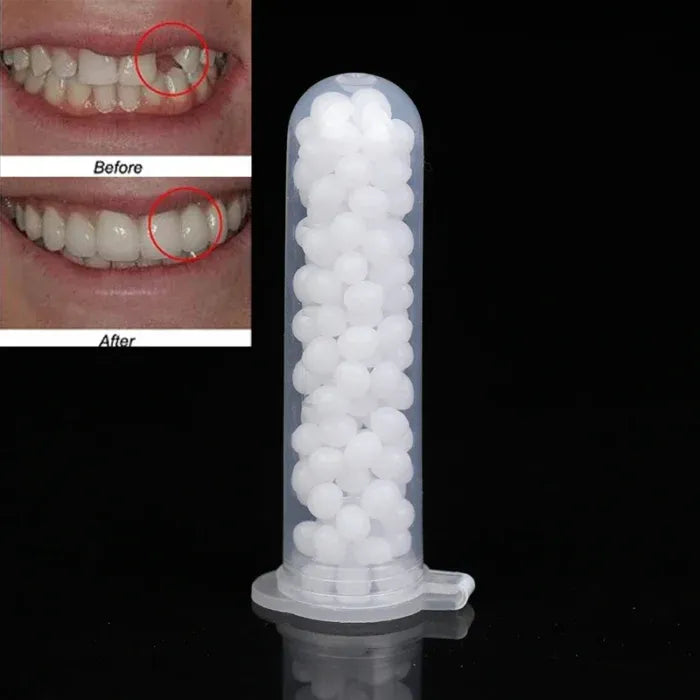 Teeth Repair Glue – Dental Fix Solution